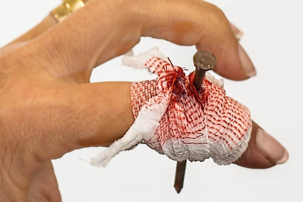 Diese Arbeitsunfälle passierten im Vorjahr